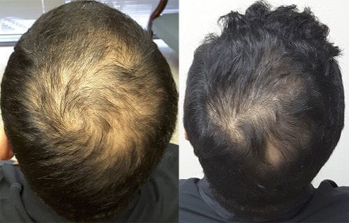 Customer photo review of SPARTAN™ - Root Activator Spray