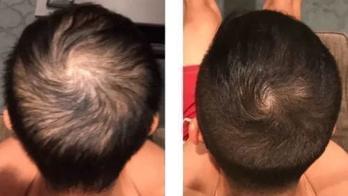 Customer photo review of SPARTAN™ - Root Activator Spray