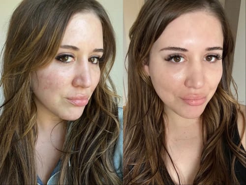 Customer photo review of The Naked Skin Bio-Collagen Mask