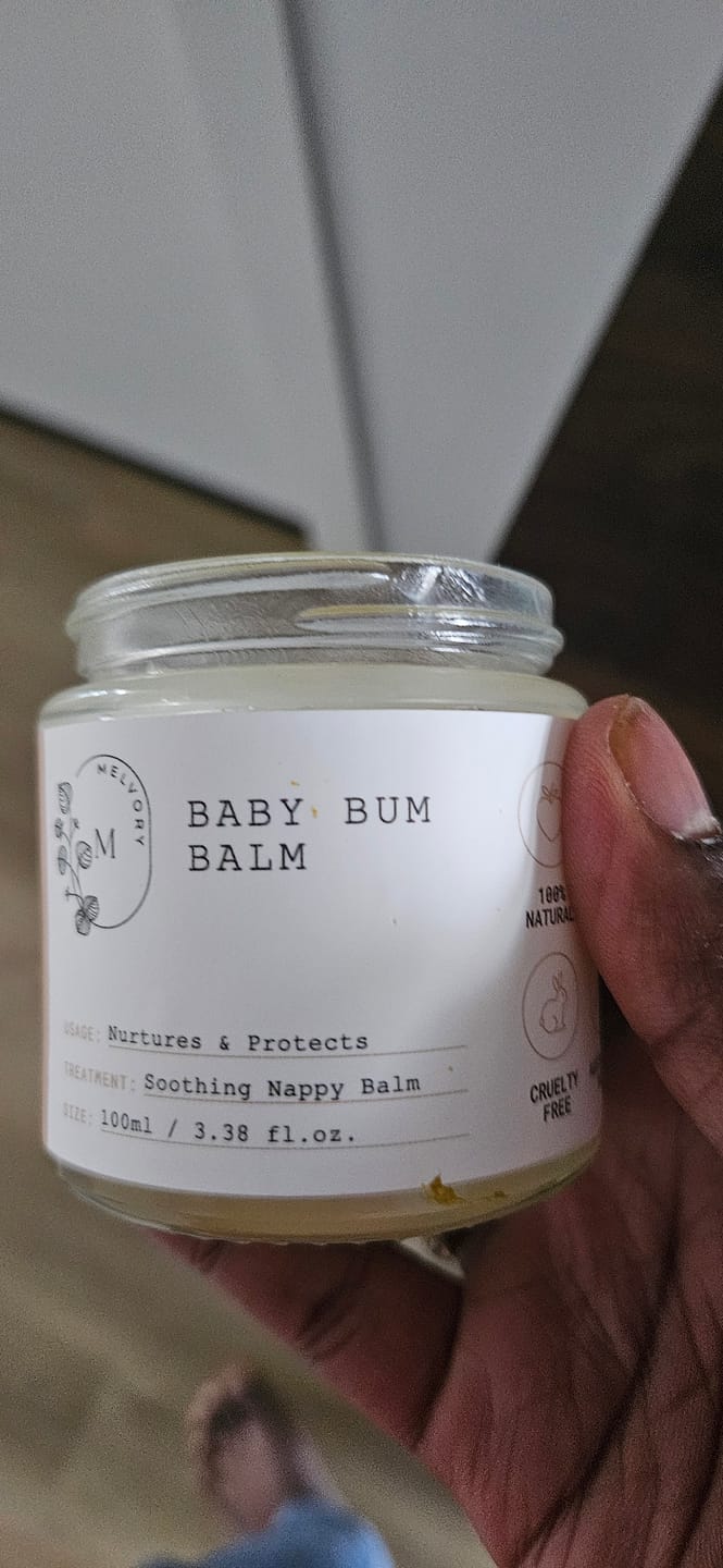 Customer photo review of Baby Bum Balm