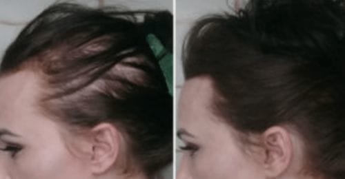 Customer photo review of SPARTAN™ - Root Activator Spray