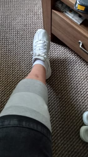 Customer photo review of Premium Bamboo Knee Sleeve (Single)