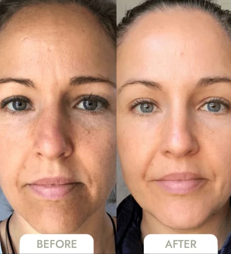 Customer photo review of The Naked Skin Bio-Collagen Mask