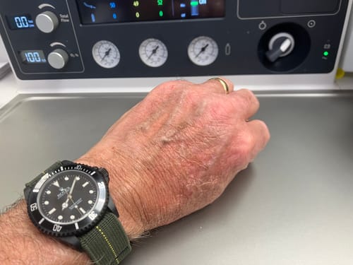 Customer photo review of The WOE-ZA Commando Strap (NEW!)