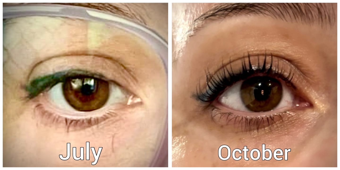 Customer photo review of Eyelash Growth Serum - Original