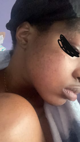 Customer photo review of LIMITED EDITION KIT Jolie’s Mini Full Body & Face Brightening Kit