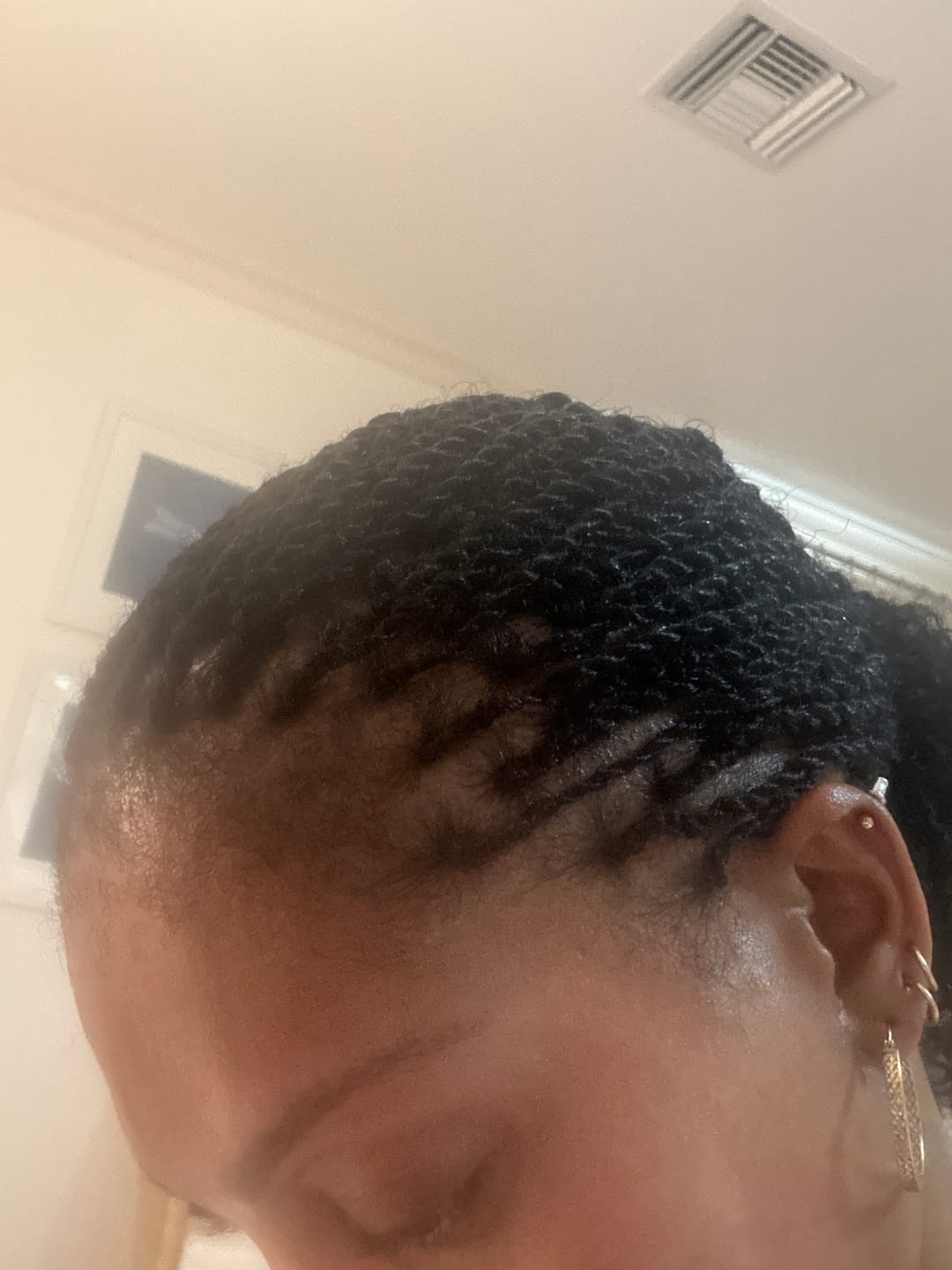 Customer photo review of Gashee Botanical Hair Supplement - Samson
