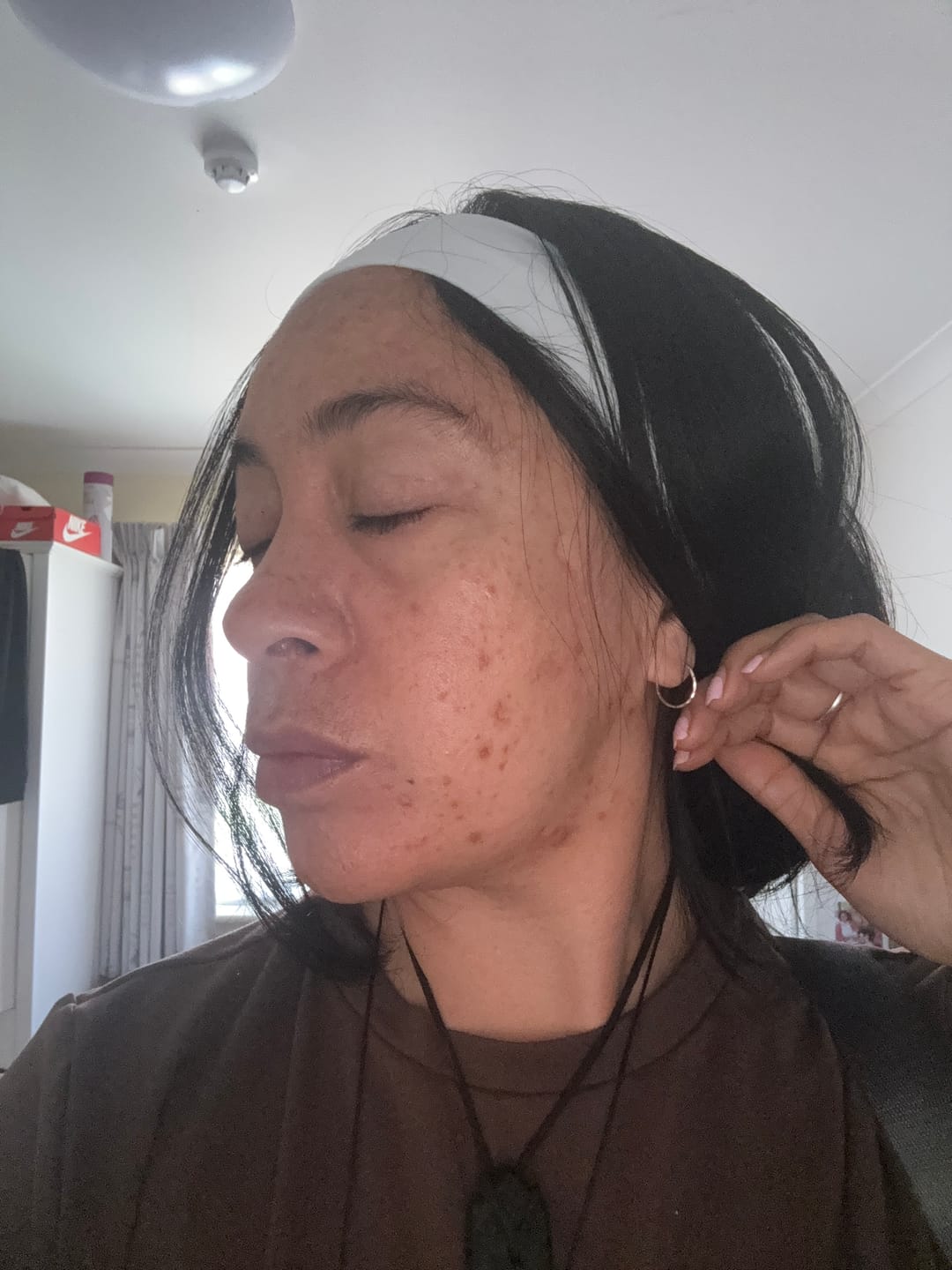 Customer photo review of Brightening Turmeric & Kojic Acid Pads