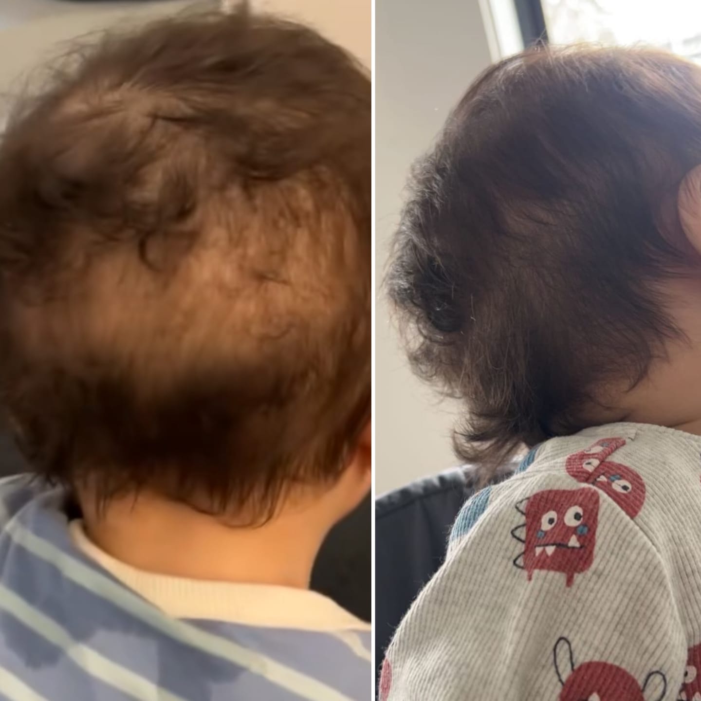 Customer photo review of Kids Hair Growth Oil