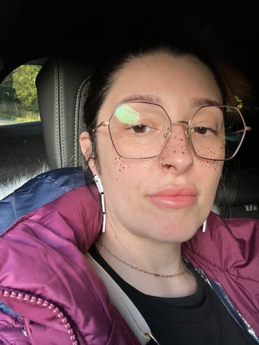 Customer photo review of Gold Glitter Freckles Makeup Patches