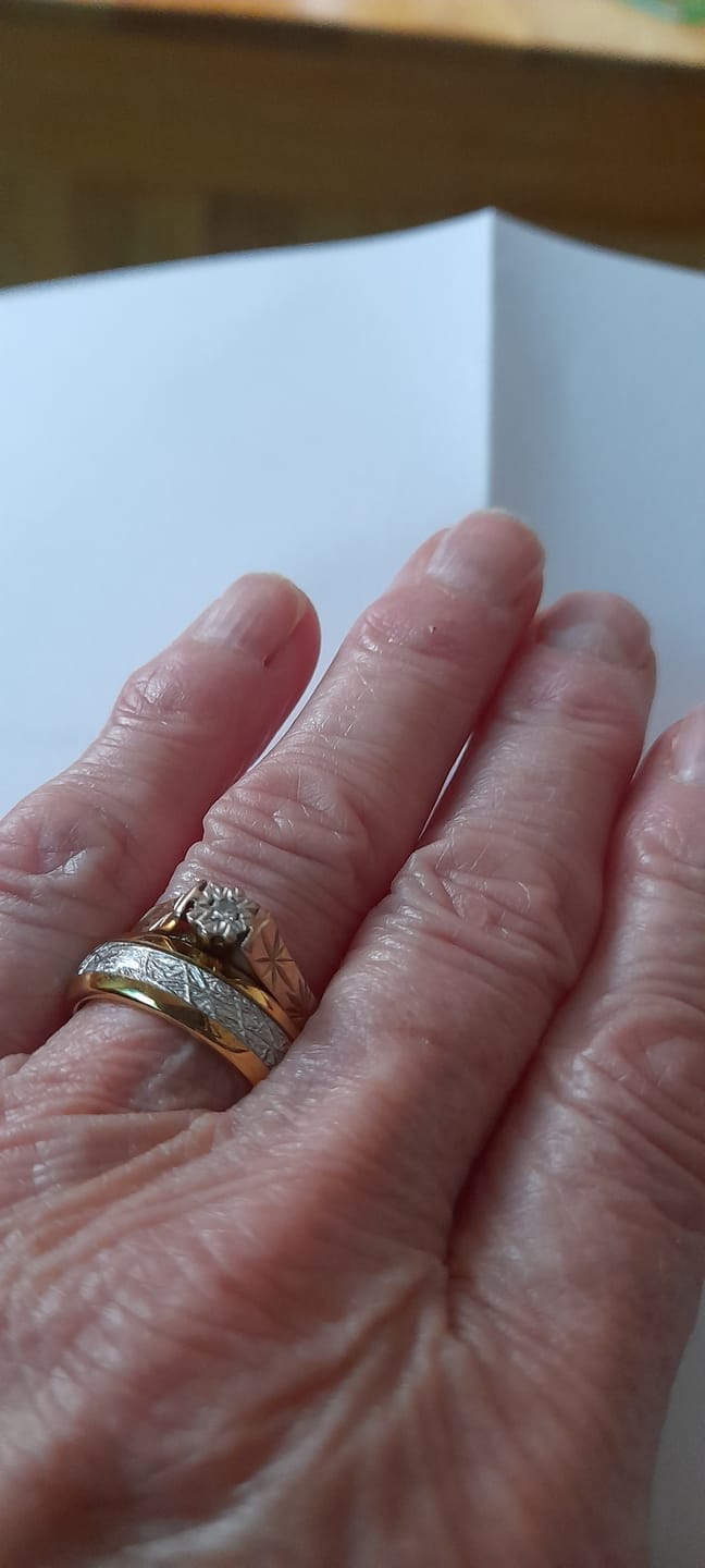 Customer photo review of The Golden Steel 6mm Wonder Ring