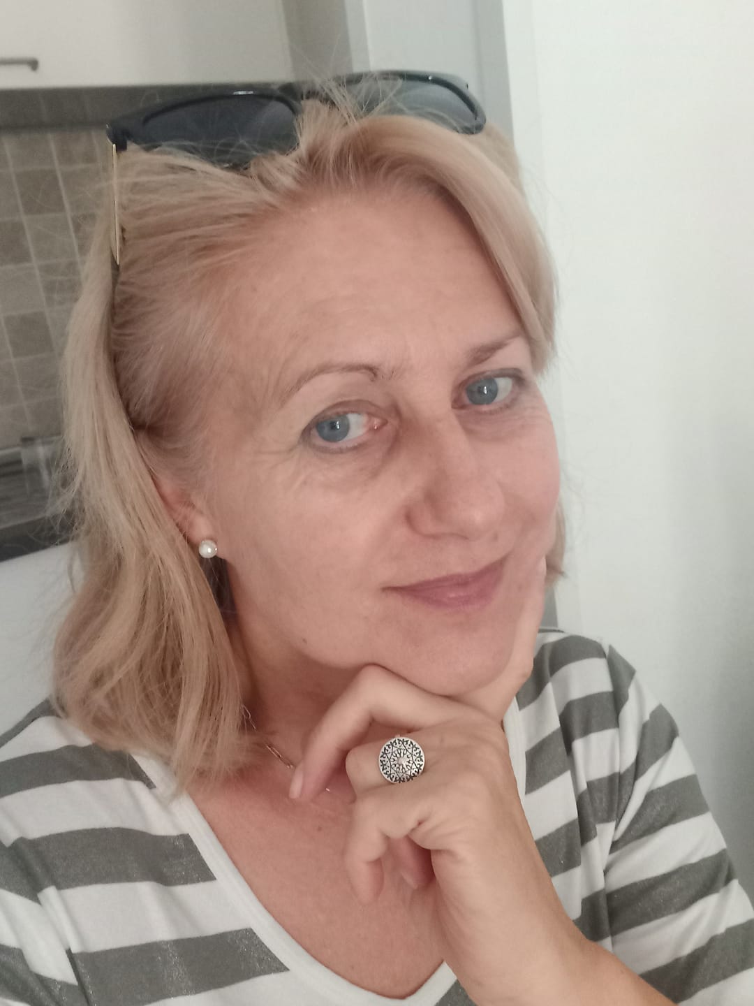 Customer photo review of COLLAGENE + H.A.™️ Efficacia ampio spettro