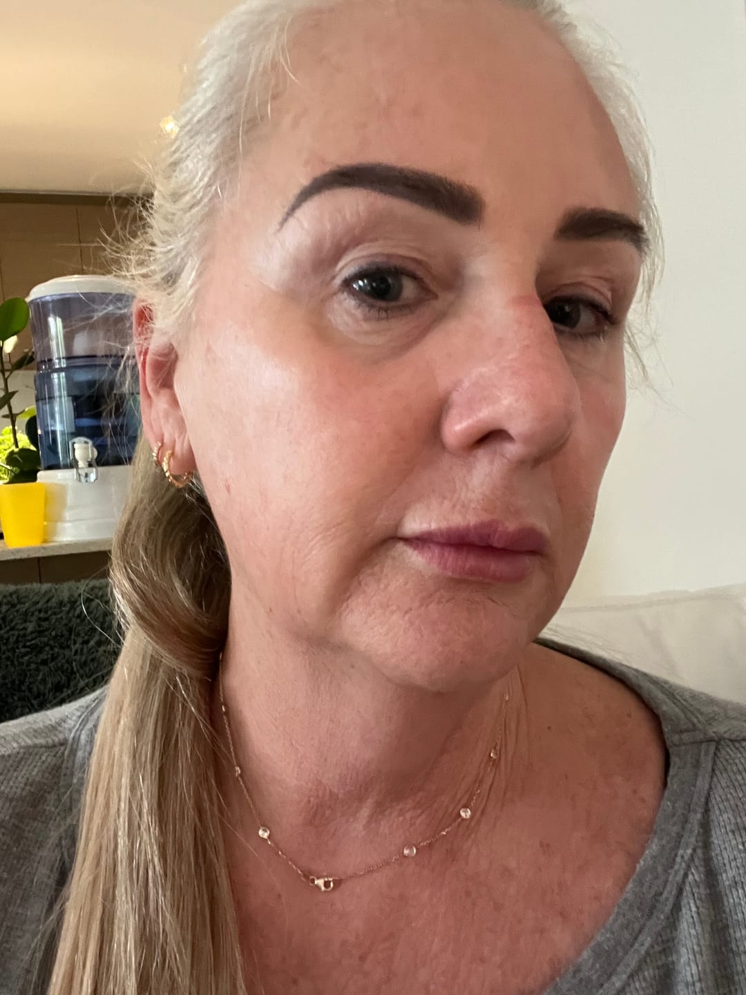 Customer photo review of The Naked Skin Bio-Collagen Mask