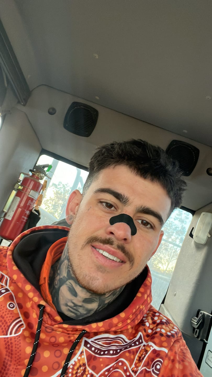 Customer photo review of Guardian Nose Strips