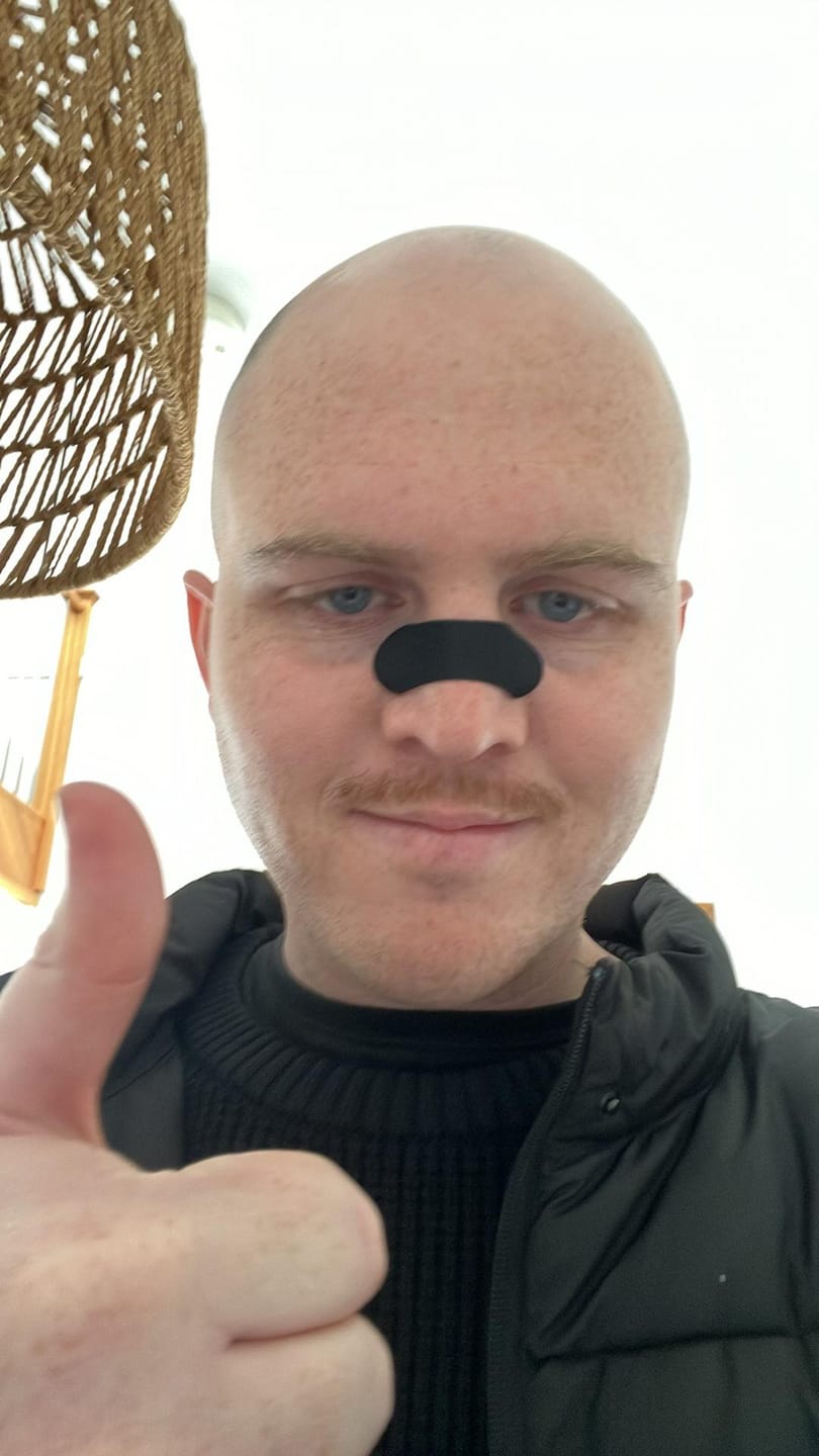 Customer photo review of Guardian Nose Strips
