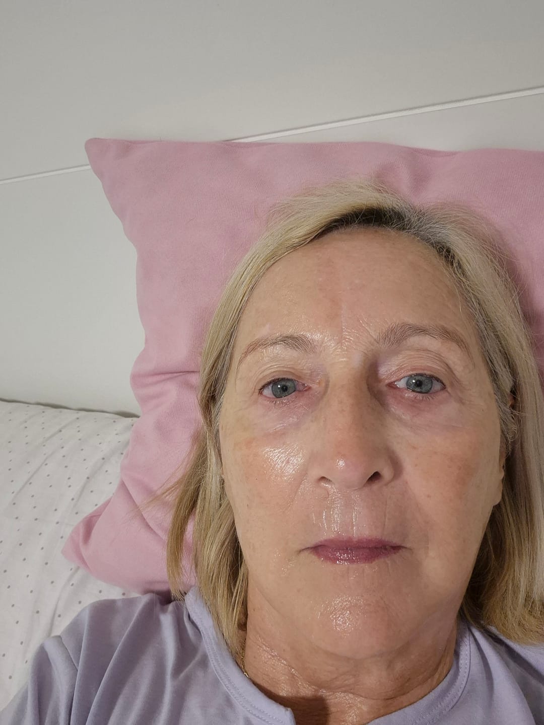 Customer photo review of Retinol 0,3% Crema transformadora noche VALENTINA