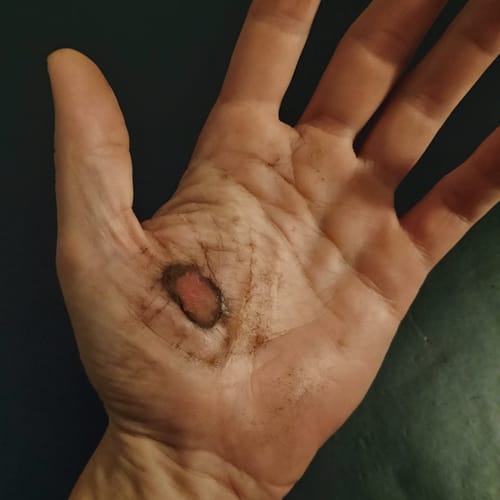 Customer photo review of Tepezcohuite Bark Powder