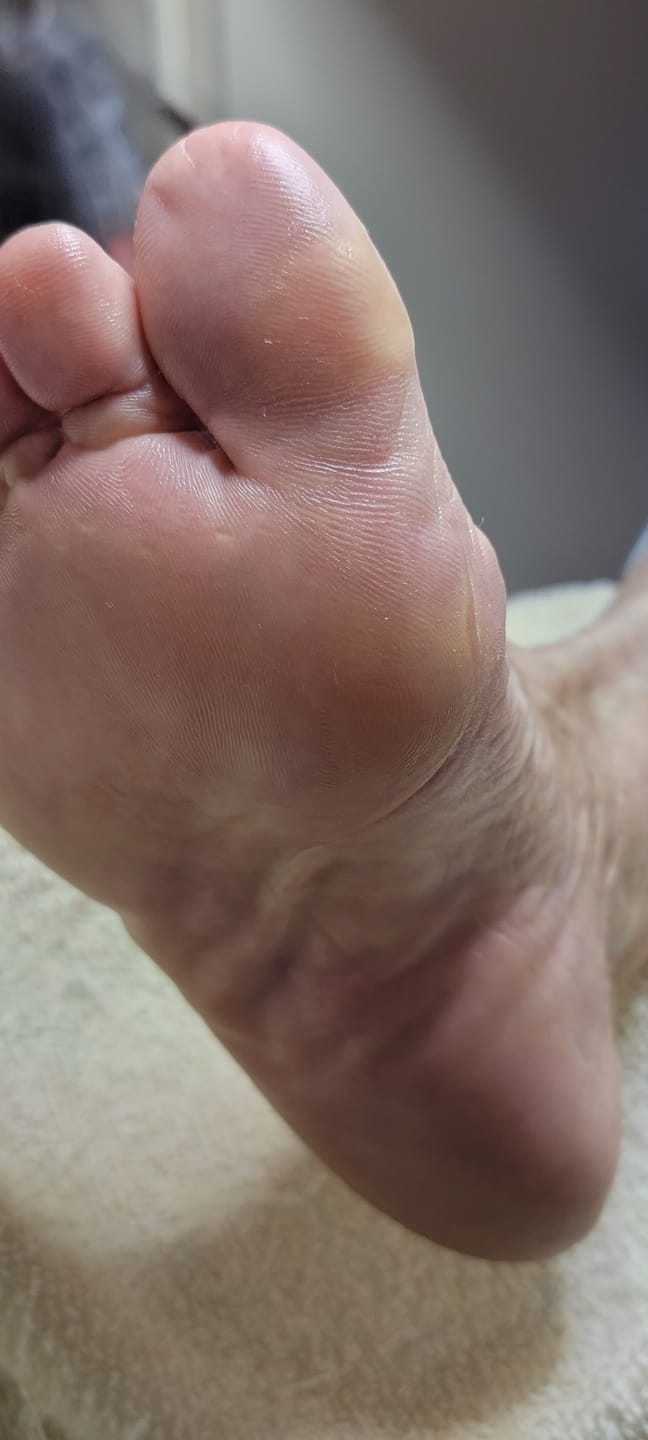 Customer photo review of Foot Balm