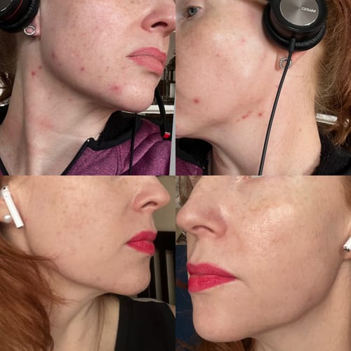 Customer photo review of Healing Balm