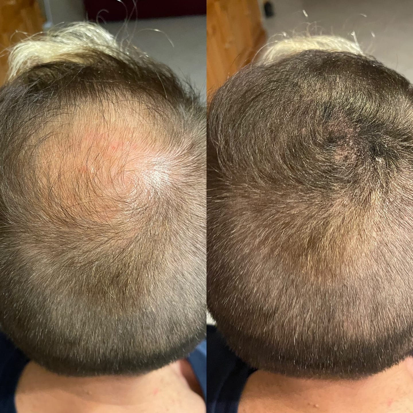 Customer photo review of Fissatore Spray Lacca per Capelli 120ml