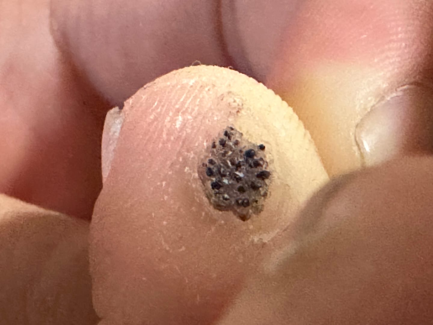 Customer photo review of The Wartabater | Electronic Wart Remover | Safe, Easy, & Effective