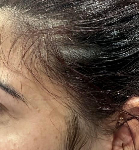 Customer photo review of Hair Growth Oil
