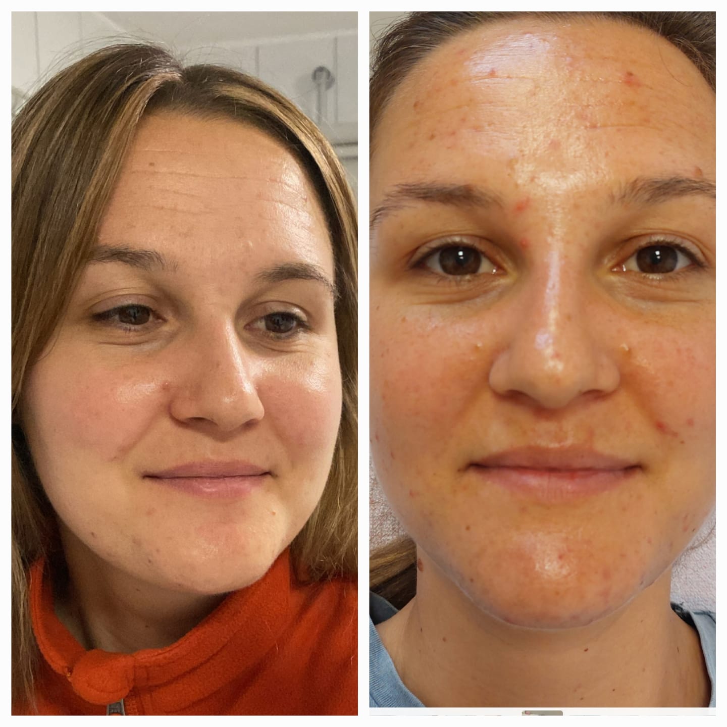 Customer photo review of SQT Recovery Set