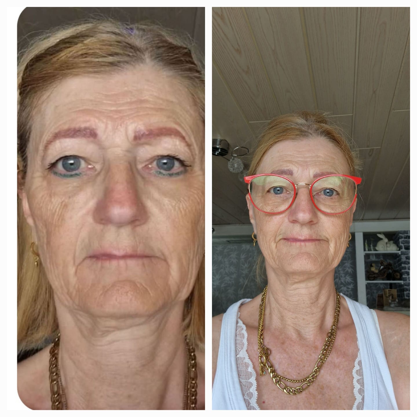 Customer photo review of Beauty Focus Collagen