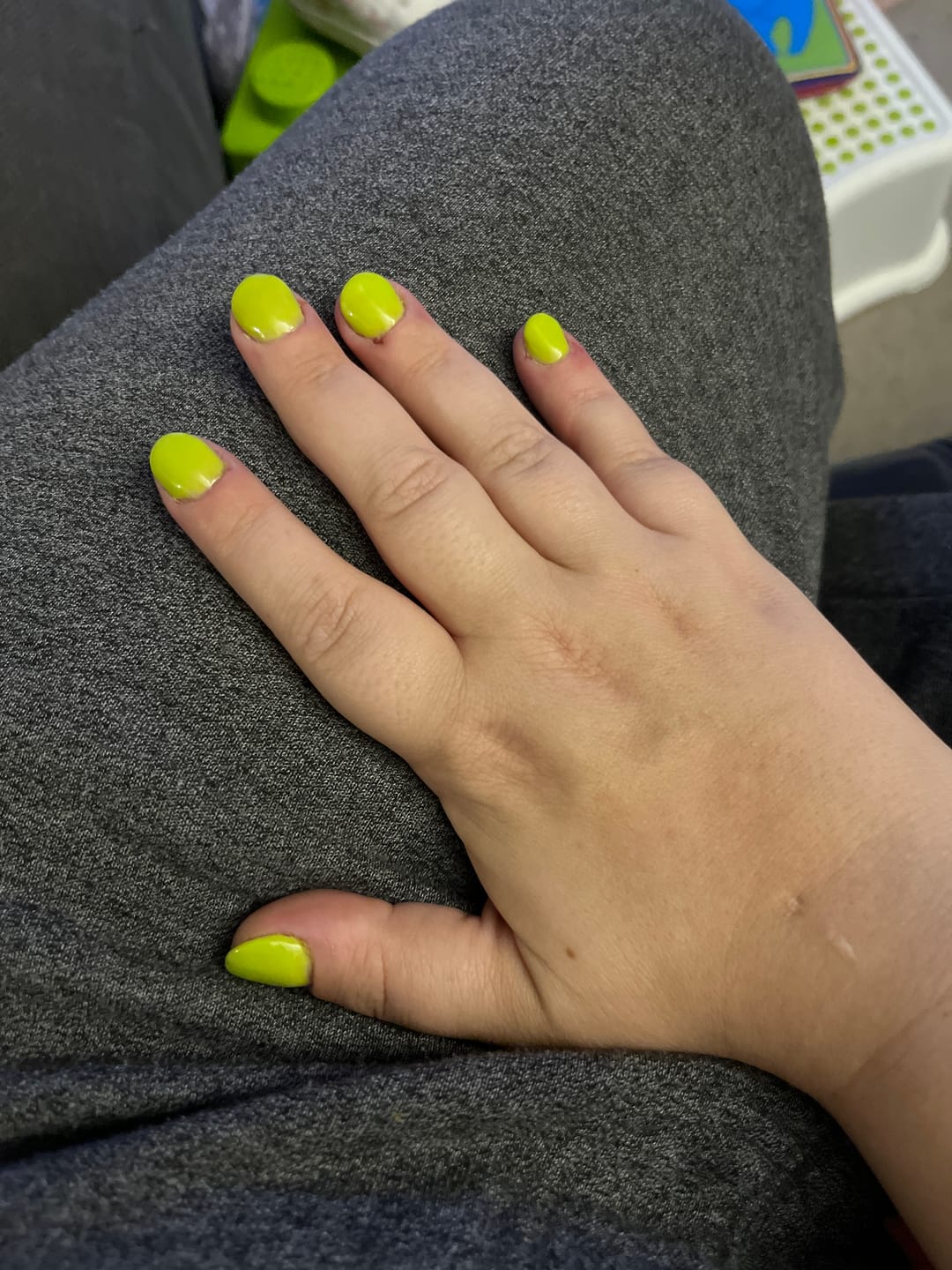 Customer photo review of Verwijderfolie (100 stuks)