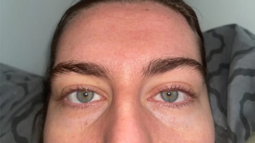 Customer photo review of NEW AND IMPROVED Lash Growth Serum