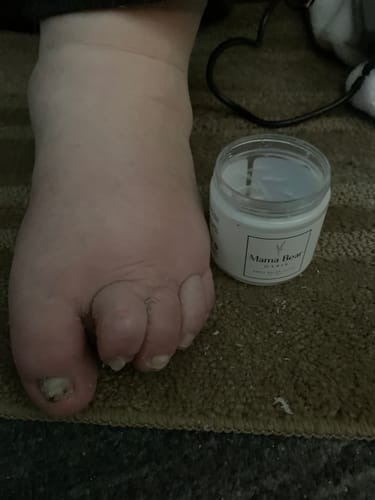 Customer photo review of Mama Bear Nerve Relief Lotion