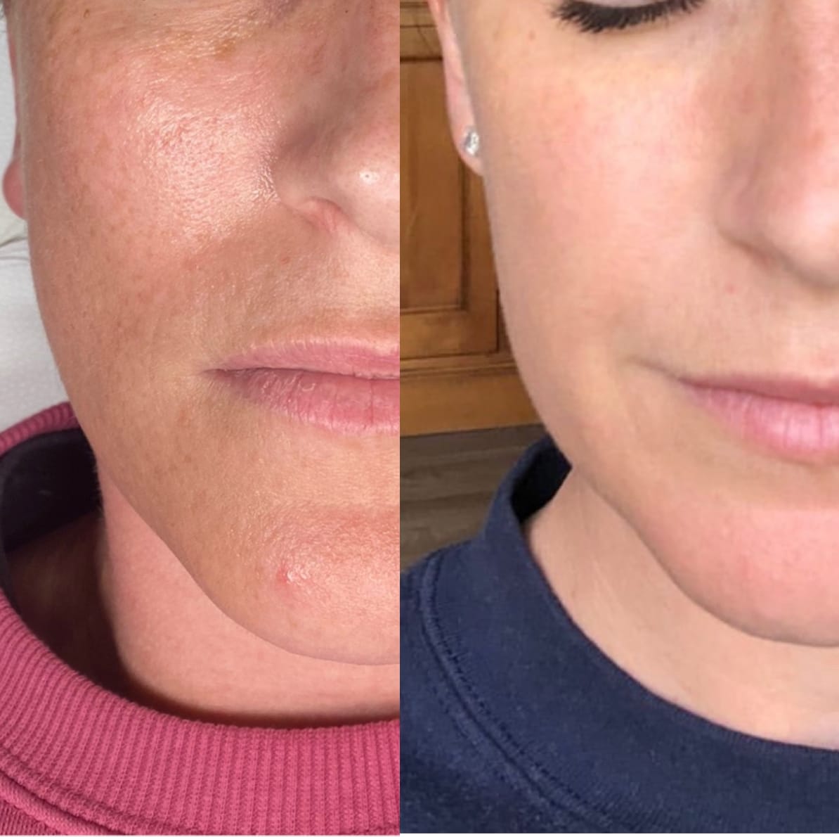 Customer photo review of HERO LIFTING GLASS SKIN MOISTURISER 50g