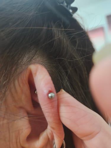 Customer photo review of Piercing Aftercare Hypochlorous Acid Spray