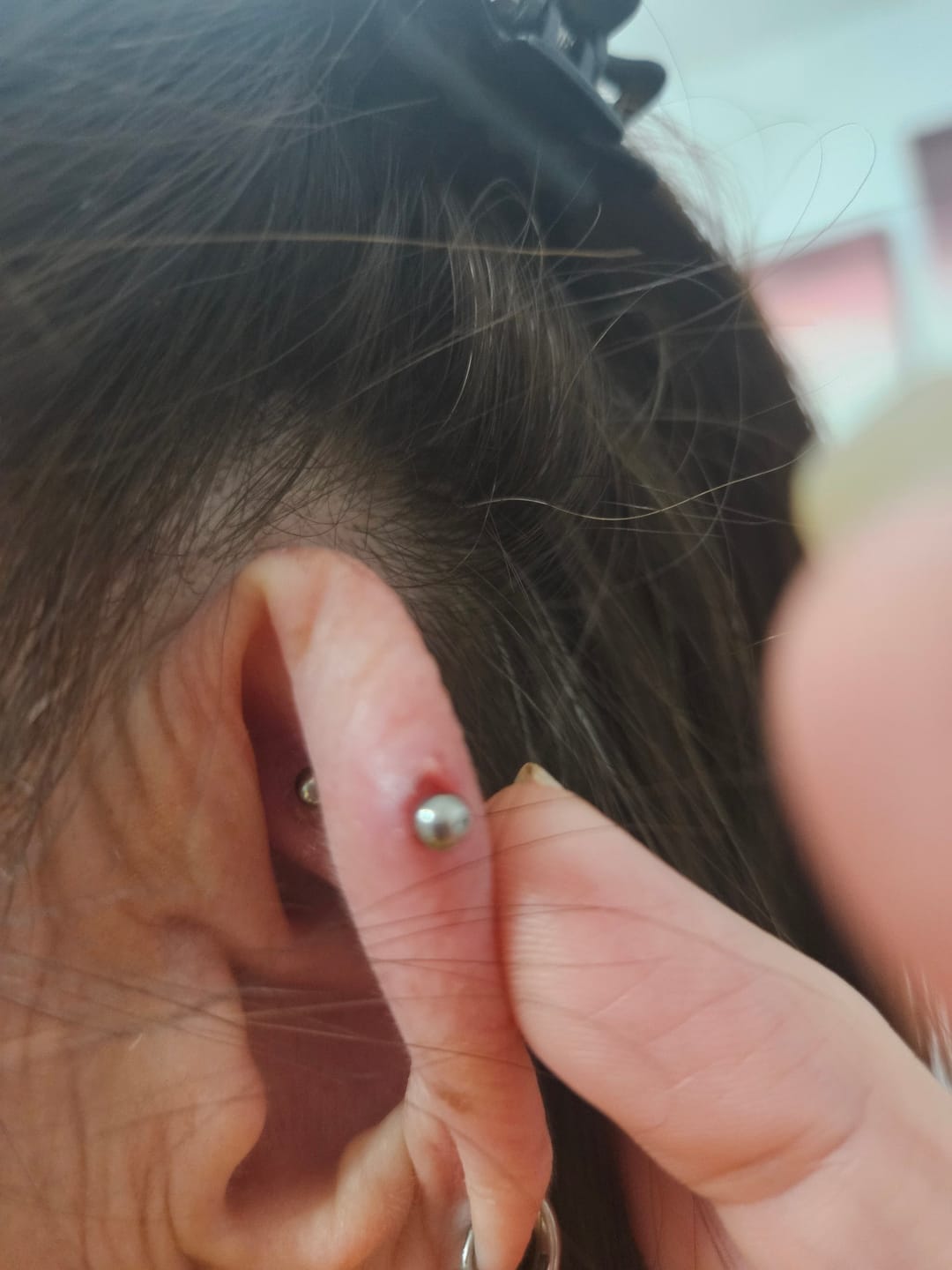Customer photo review of Piercing Aftercare Hypochlorous Acid Spray