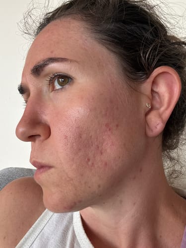 Customer photo review of Sea Cucumber Collagen Rescue & Repair Pack
