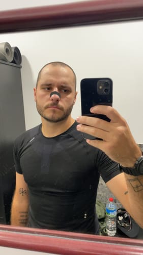 Customer photo review of Shipping insurance