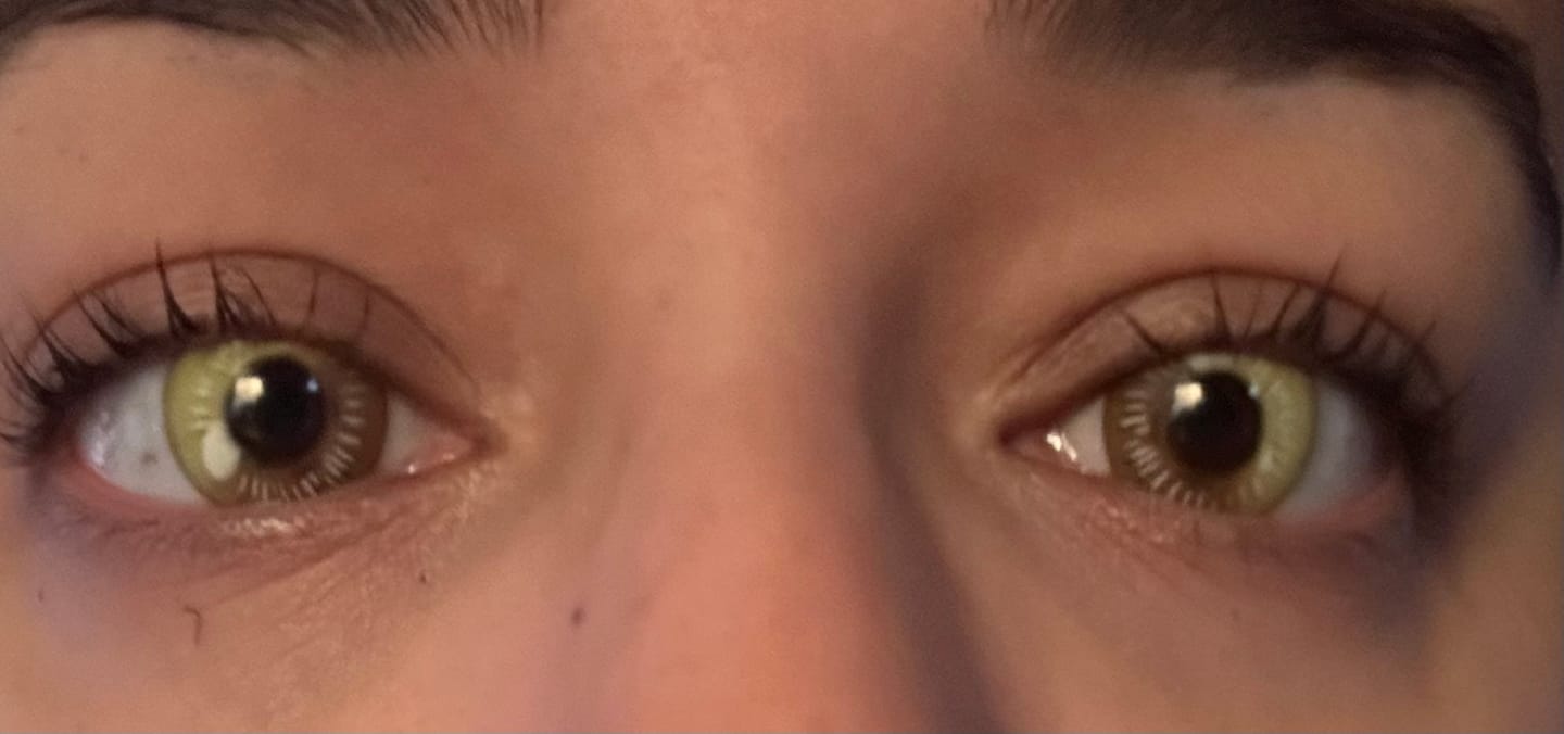 Customer photo review of Cosplay Anime Yellow Prescription Coloured Contact Lenses