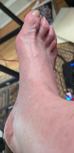 Customer photo review of Mama Bear Nerve Relief Lotion