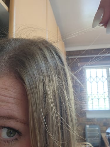 Customer photo review of Hair & Nail Capsules