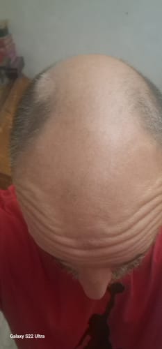 Customer photo review of Coffret pousse Intense cheveux - ECLAMA