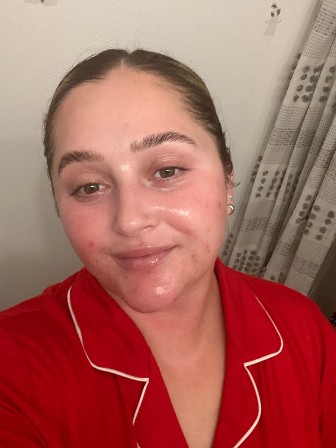 Customer photo review of Brightening Anti-Oxidant Serum (BAOS)