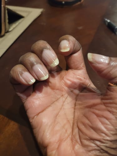 Customer photo review of Rocket Nail Fuel Repair Original Duo