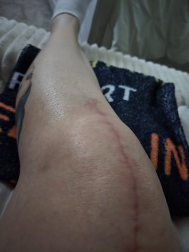 Customer photo review of Pain Relief Salve 1000/2000Mg CBD 2 Oz.