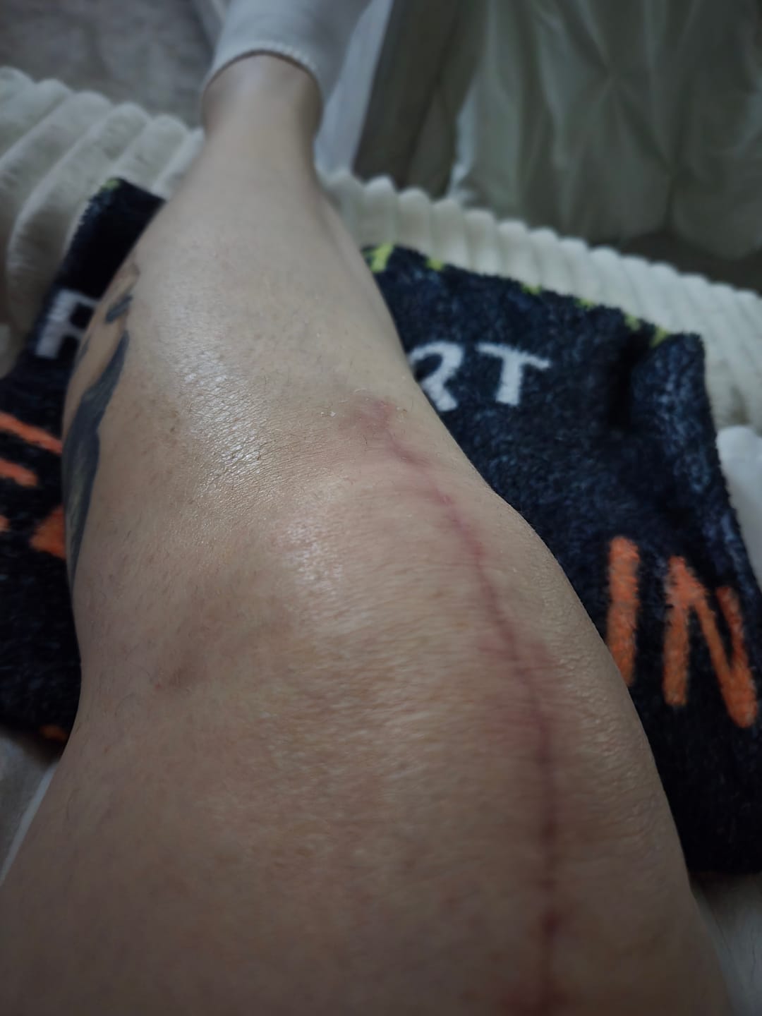 Customer photo review of Pain Relief Salve 1000/2000Mg CBD 2 Oz.