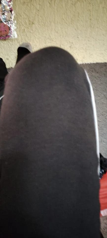 Customer photo review of Al Aras™ Advanced Knee Massager