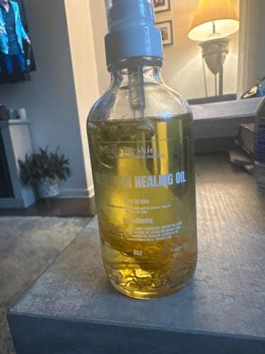 Customer photo review of Calendula Healing Oil