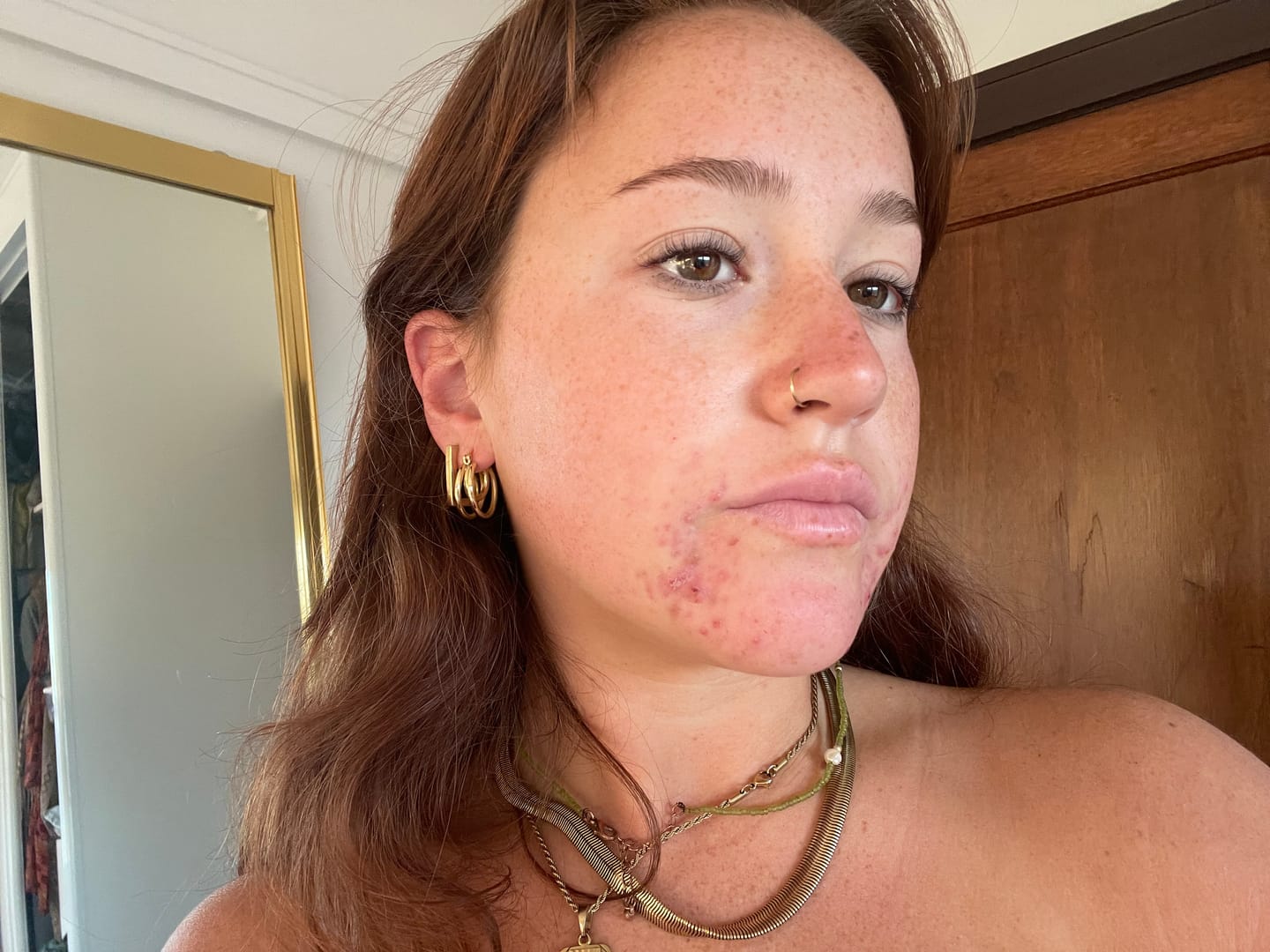 Customer photo review of Forever Bright Skin Set