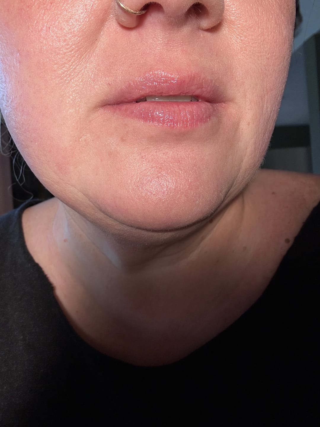 Customer photo review of Plush Ritual Recovery - Ceramide Lip Treatment