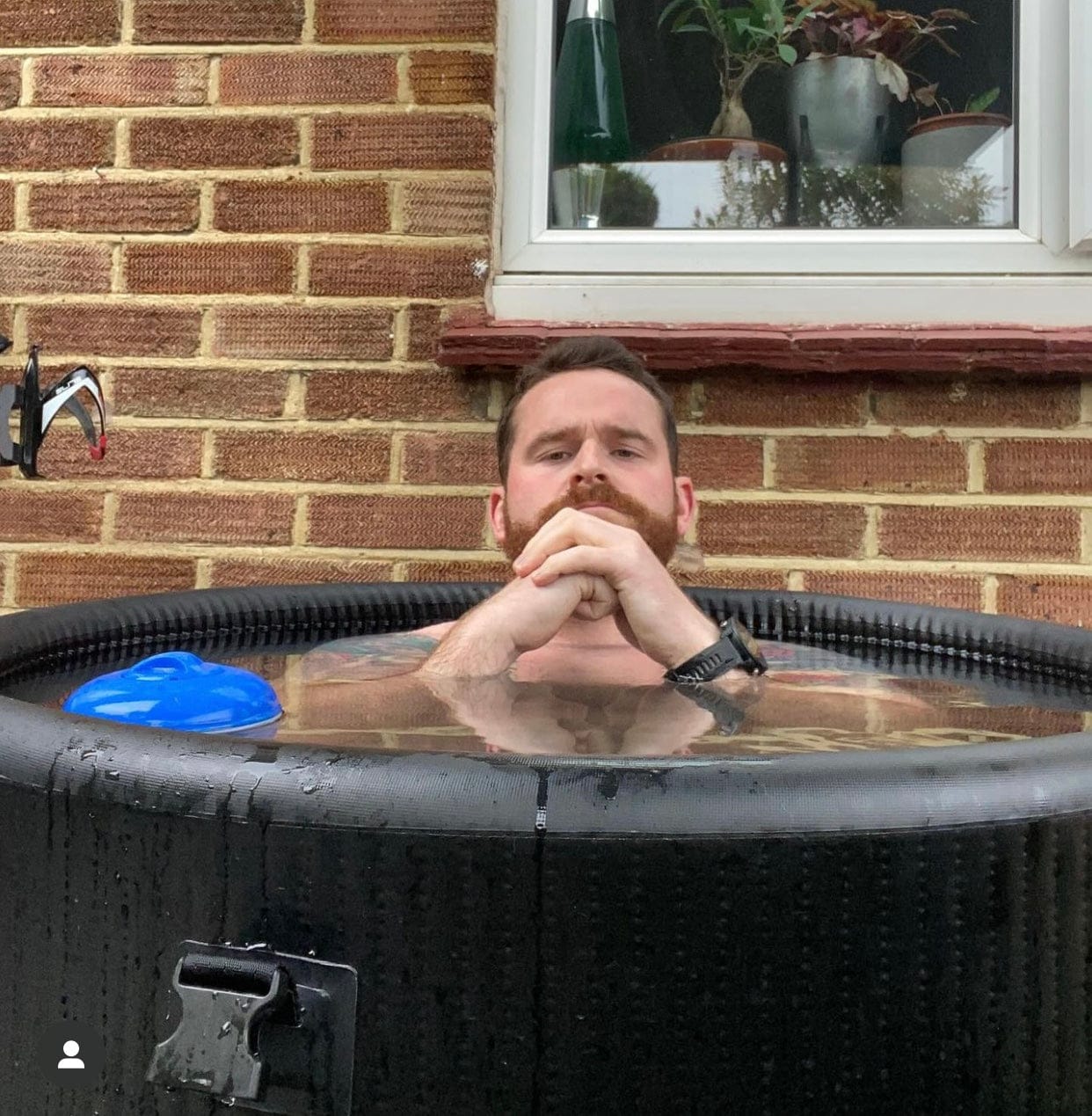 Customer photo review of MyoIce Pro
