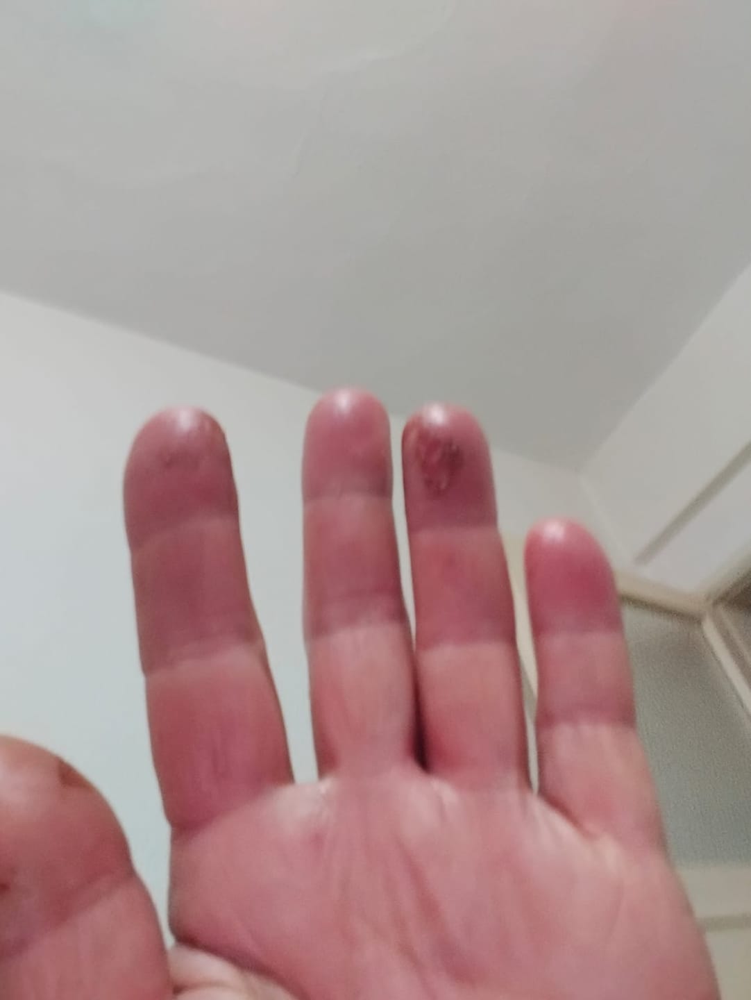 Customer photo review of Remedium SOS Onarıcı Bakım Kremi